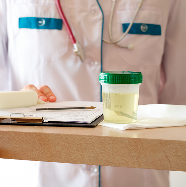 contenitori-urintainer-120-ml-4 (1) urintainer® 120 ml containers: reliability, safety and suitability