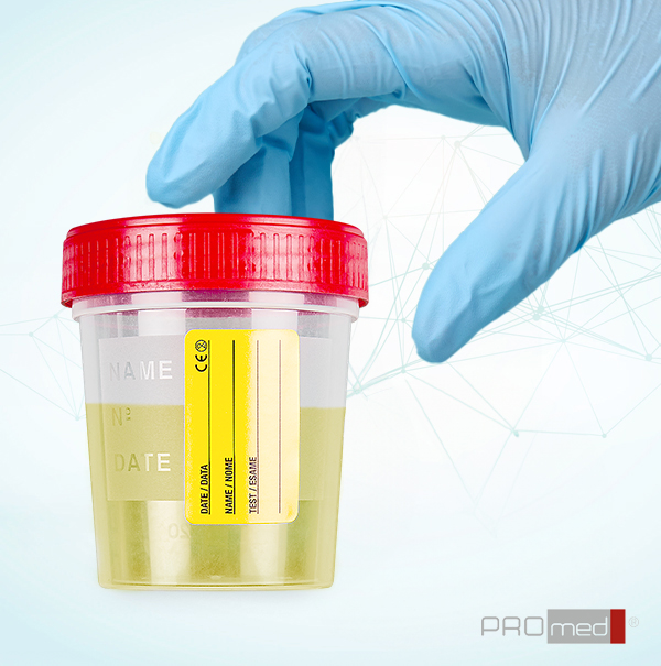 contenitori-urintainer-120-ml-hand-2 urintainer® 120 ml containers: reliability, safety and suitability